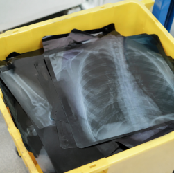 Radiographies empilees dans un bac de recyclage medical