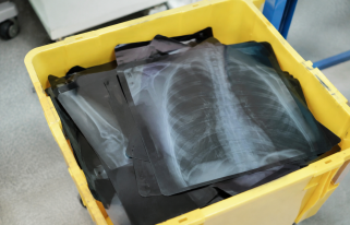 Radiographies empilees dans un bac de recyclage medical
