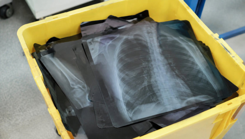Radiographies empilees dans un bac de recyclage medical